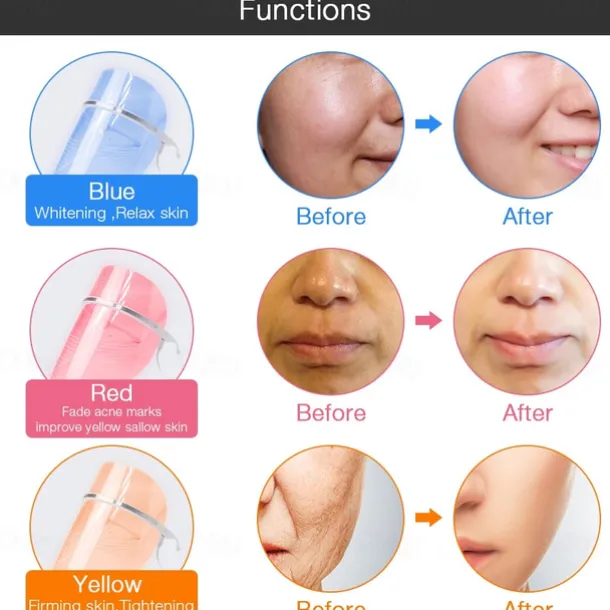 3 Colors Led Facial Mask Led Korean Photon Therapy Face Mask Machine Light Therapy Acne Mask Neck Beauty Led Mask