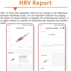 696 F210 Smart Watch 1.55 inch Smart Band Fitness Bracelet Bluetooth ECG+PPG Pedometer Call Reminder Compatible with Android iOS Men Hands-Free Calls Message Reminder IPX-0 48mm Watch Case