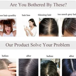 100% Human Hair Extensions 120% Density Silk Base Top Hairpiece Clip In On Hair Topper With Bangs For Women Hand-made Top Hair Piece Middle Part With Thinning Hair #27 Dark Blonde