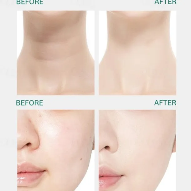 3 in 1 Face Neck Massager ION LED Photon Therapy Facial Lifting Beauty Devices Remove Double Chin Anti Wrinkle Skin Care Tools