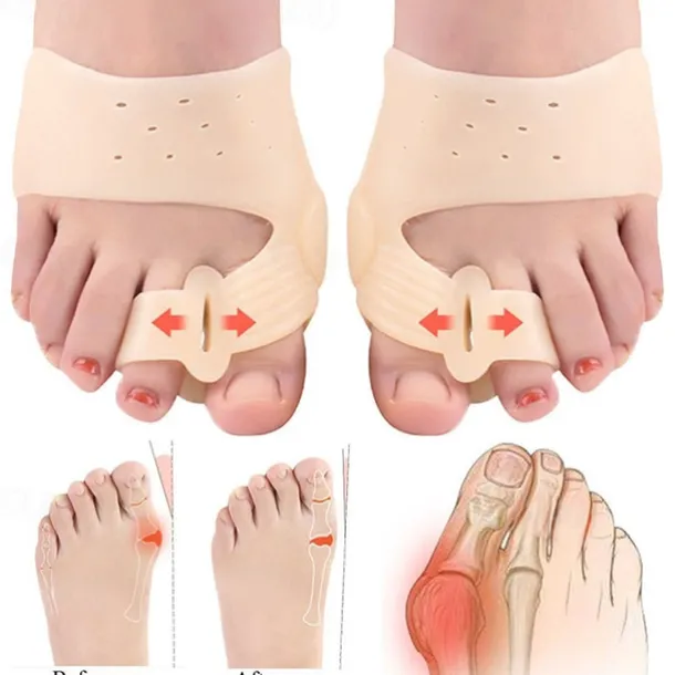 2 Pieces Silicone Gel Toes Separator Hallux Valgus Corrector Bunion Bone Ectropion Adjuster Toes Outer Foot Care