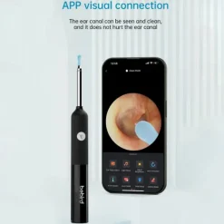 Bebird Ear Care Wax Removal Tool Camera Cleaning Kit- Wireless Cleaner Ear Cleaner with Camera