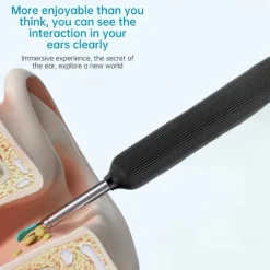 Bebird Ear Care Wax Removal Tool Camera Cleaning Kit- Wireless Cleaner Ear Cleaner with Camera
