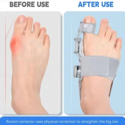Bunion Corrector for Women Men Adjustable Universal Size Bunion Splint Big Toe Straightener Toe Separators for Bunions with 2 Silicone Pads Better Fit to the Toes Without Damaging the Skin