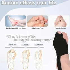 Bunion Corrector for Women Big Toe, Bunion Corrector for Men, Bunion Relief, Bunion Pads, Big Toe Splint, Bunion Fix Preventer Device for Day/Night (2 Count) Black L