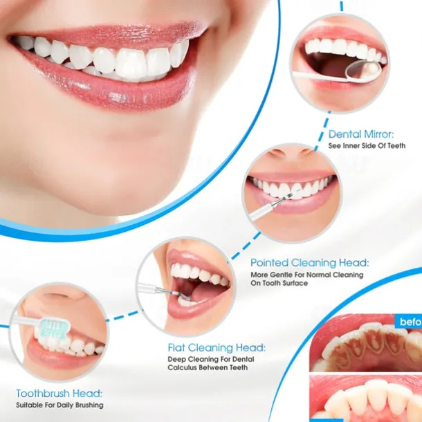 Electric Sonic Dental Irrigator Scaler Teeth Whitening Portable Ultrasonic Tartar Calculus Remover Teeth Cleaning Tool