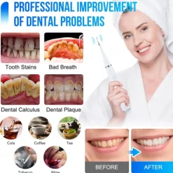Electric Toothbrush Sonic Dental Scaler Teeth Whitening kit Tooth Whitener Calculus Tartar Remover Tools Cleaner Stain Oral Care