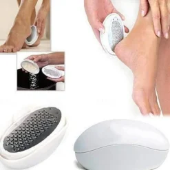 Foot Grinder Egg Shape Pedicure Foot Scraper File with Stainless Steel Head for Quick Removal of Hard Skin