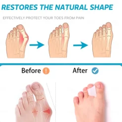 Hammer Toe Straightener Corrector - Toe Spacers Toe Separators for Bunion, Curled Toes, Hammertoes, Toe Corrector Toe Splint for Men and Women 6 Pack