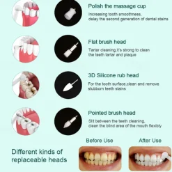 Oral Electric Teeth Polisher Dental Tartar Remover Plaque Stains Cleaning Multifunctional Tooth Whitening Tool Calculus Removal