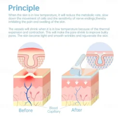 Original Skincare Ice Roller For Face SOICY S20 Derma Cooler Massager For Face Lift Sun Damage Redness Pain Relife