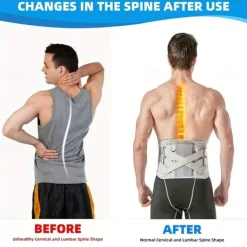 1pc Back Support Brace - Perfect For Women & Men With Herniated Discs & Sciatica