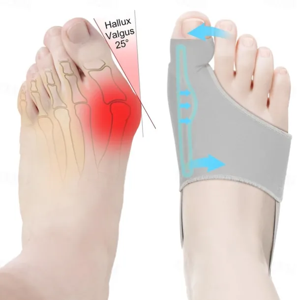 2Pcs Bunion Corrector for Women Men Big Toe Straightener Bunions Correction Women Men Bunion Splint Bunion Pads for Bunions Relief Hallux Valgus Pain Relief Comfortable Breathable for Day Night