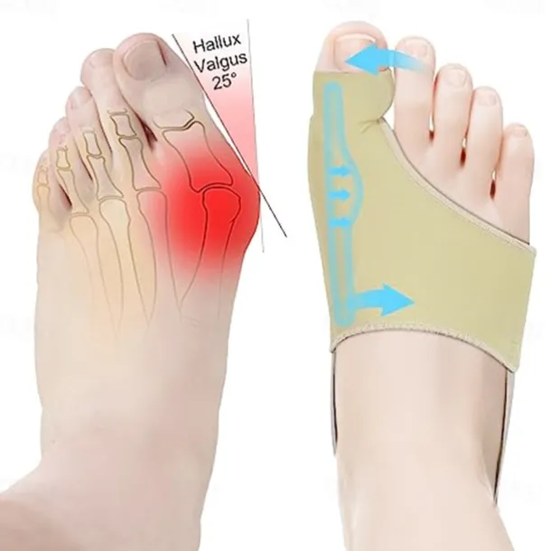 2Pcs Bunion Corrector for Women Men Big Toe Straightener Bunions Correction Women Men Bunion Splint Bunion Pads for Bunions Relief Hallux Valgus Pain Relief Comfortable Breathable for Day Night