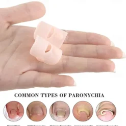 2PCS Silicone Ingrown Toenail Corrector – Invisible Toe Nail Straightening Brace, Pedicure Foot Care Tool for Paronychia Treatment & Nail Healing Protection