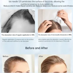 120Pin Bio Needle Derma Stamp For Hair Growth Adjustable Needle Length Microneedling For Skincare