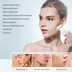 120Pin Bio Needle Derma Stamp For Hair Growth Adjustable Needle Length Microneedling For Skincare