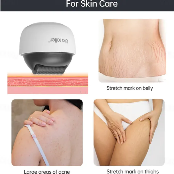 1200Pin Derma Roller For Face Body Acne Stretchmark Removal Microneedle Roller For Beard Hair Growth