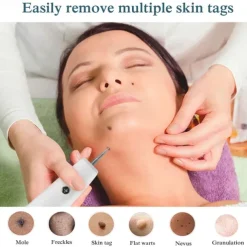 Skin Tag Remover 15 Level Laser Plasma Pen Freckle Mole Warts Removal Lcd Nevus Tattoo Black Spots Remover Blemish Removal