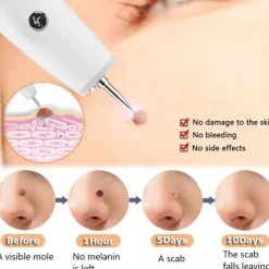 Skin Tag Remover 15 Level Laser Plasma Pen Freckle Mole Warts Removal Lcd Nevus Tattoo Black Spots Remover Blemish Removal