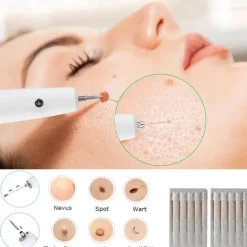 Skin Tag Remover 15 Level Laser Plasma Pen Freckle Mole Warts Removal Lcd Nevus Tattoo Black Spots Remover Blemish Removal