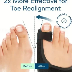 Toe Separator For Bunion Relief, (Fit Up To 100kg) Bunion Corrector For Women And Men Big Toe Pain Relief Set, Day & Night 24hrs Support Big Toe Straightener, Big Toe Hammer Bunion