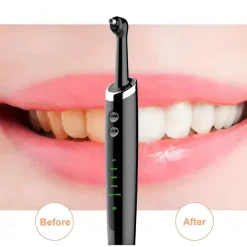 Tooth Polisher Electric Professional with 5 Replacement Heads and 5 Clean Mode USB Charging Waterproof Tooth Polisher Kit