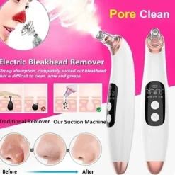 Wireless Electric Blackhead Remover Pore Vacuum Acne Pimple Removal Tool Acne Needle Set