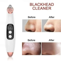 Wireless Electric Blackhead Remover Pore Vacuum Acne Pimple Removal Tool Acne Needle Set